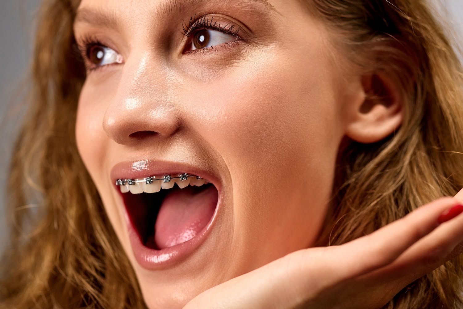 Immagine di una persona che indossa un apparecchio ortodontico